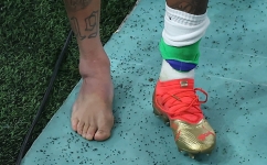 Picture of the swollen ankle of Neymar taken as he leaves the field at the end of the Qatar 2022 World Cup Group G match against Serbia at the Lusail Stadium in Lusail on November 24, 2022. (Photo by Giuseppe CACACE / AFP)