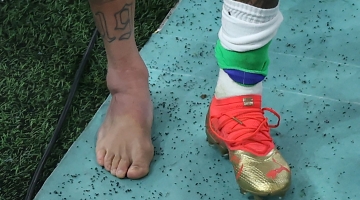 Picture of the swollen ankle of Neymar taken as he leaves the field at the end of the Qatar 2022 World Cup Group G match against Serbia at the Lusail Stadium in Lusail on November 24, 2022. (Photo by Giuseppe CACACE / AFP)