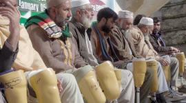 تركيب الأطراف الصناعية لذوي الإعاقة