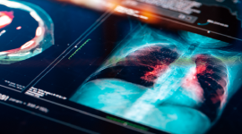 صورة تعبيرية