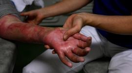 صورة تعبيرية