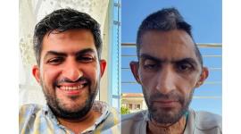 الأسير المحرر مجاهد بني مفلح قبل وبعد الاعتقال