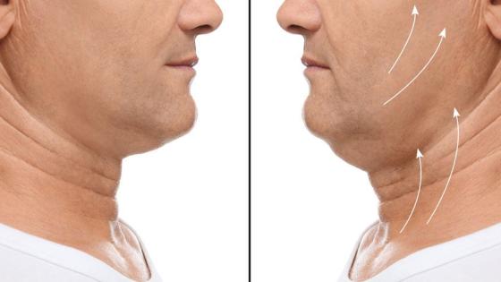 صورة توضيحية