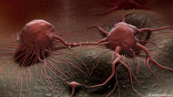 صورة تعبيرية