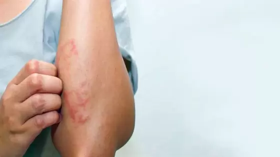 صورة تعبيرية