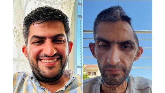 الأسير المحرر مجاهد بني مفلح قبل وبعد الاعتقال