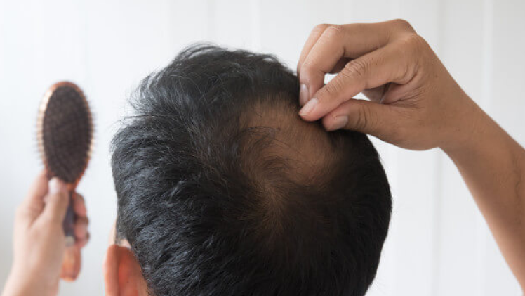 صورة تعبيرية