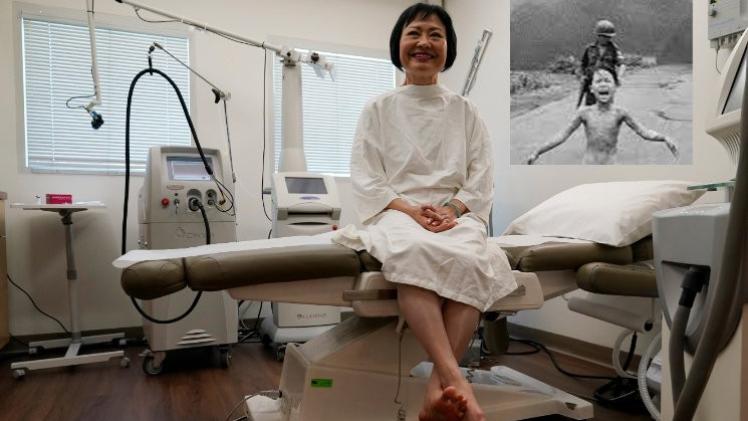 كيم فوك فان ثي المعروفة عالميا باسم "فتاة النابالم"