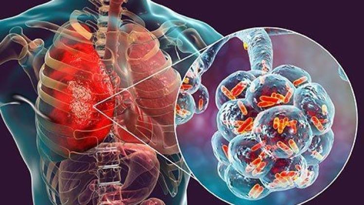 صورة تعبيرية