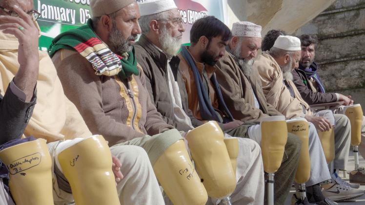 تركيب الأطراف الصناعية لذوي الإعاقة