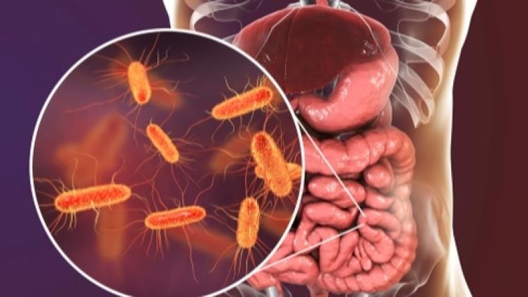 صورة تعبيرية