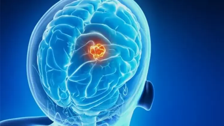 صورة تعبيرية