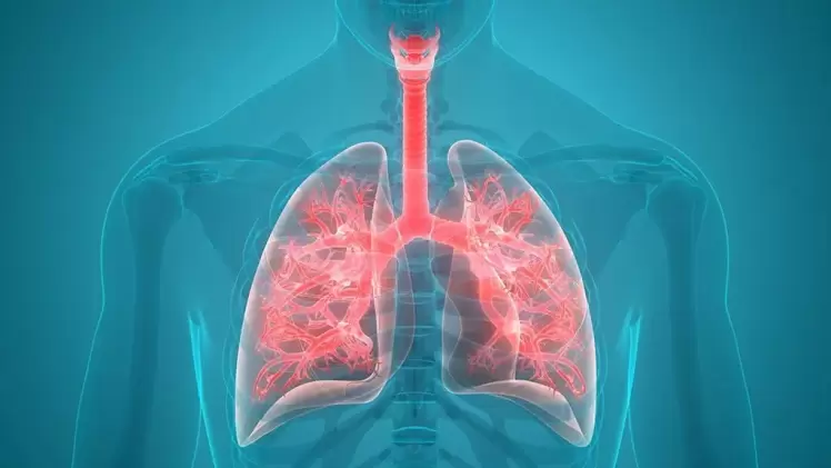 صورة تعبيرية