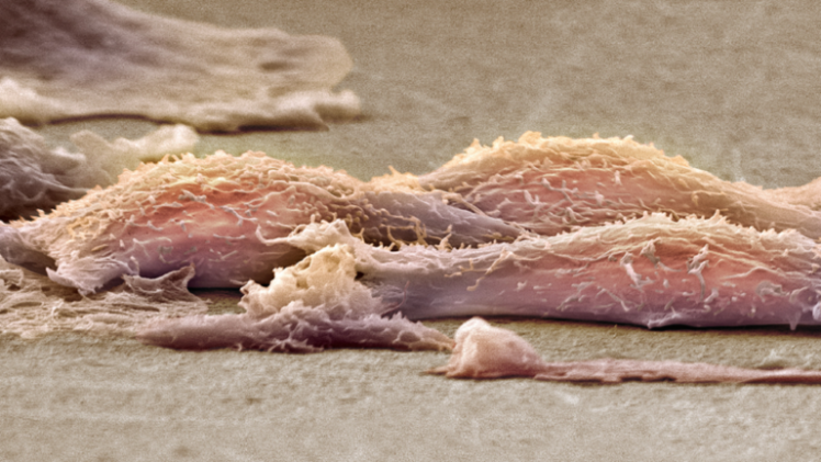 صورة تعبيرية