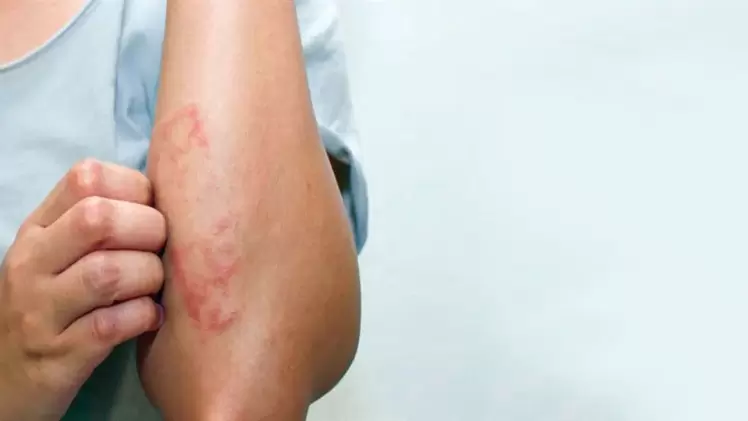 صورة تعبيرية