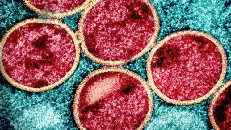 صورة تعبيرية