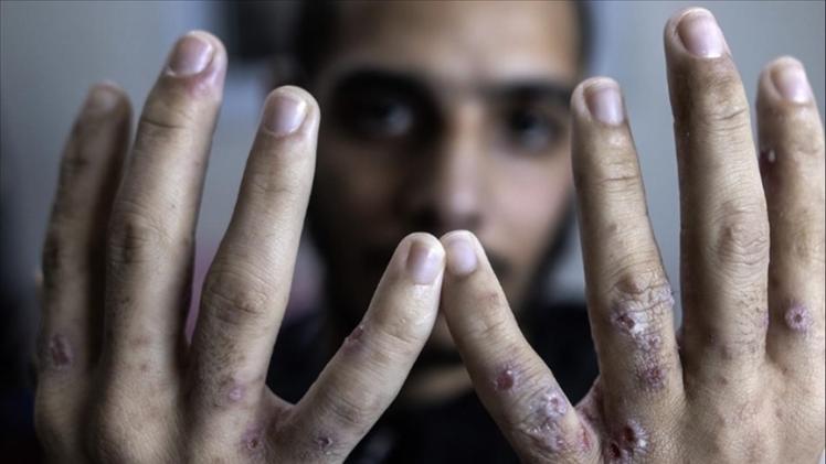 صورة أرشيفية